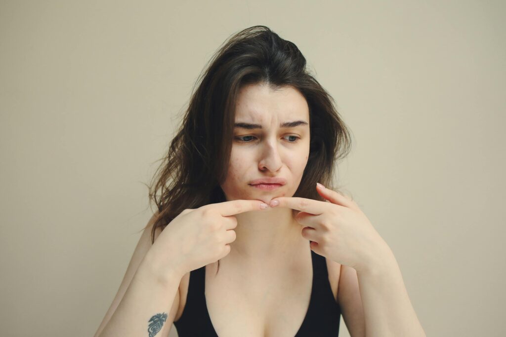 A woman looks at her skin with concern, touching her chin, worried about acne.